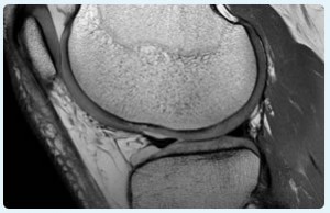 3T MRI Musculoskeletal knee joints