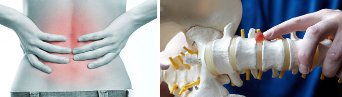 spine-injection